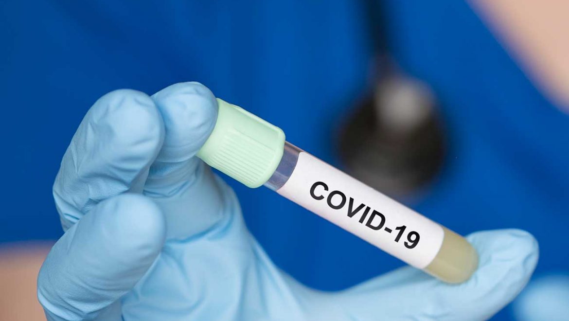עם עזרה מבעלי החיים: טיפול למחלה COVID-19 המבוסס על נוגדנים